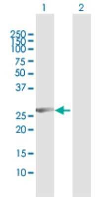 Western Blot: CCNB1IP1 Antibody [H00057820-D01P] - Analysis of CCNB1IP1 expression in transfected 293T cell line by CCNB1IP1 polyclonal antibody.Lane 1: CCNB1IP1 transfected lysate(31.50 KDa).Lane 2: Non-transfected lysate.