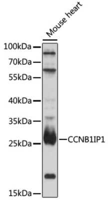 Western Blot: CCNB1IP1 Antibody [NBP2-92337] - Analysis of extracts of mouse heart, using CCNB1IP1 .Exposure time: 90s.