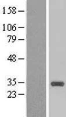 Western Blot: CCNB1IP1 Overexpression Lysate (Adult Normal) [NBP2-04816] Left-Empty vector transfected control cell lysate (HEK293 cell lysate); Right -Over-expression Lysate for CCNB1IP1.