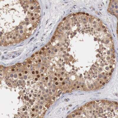 Immunohistochemistry-Paraffin CCNB3 Antibody