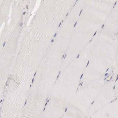 Immunohistochemistry-Paraffin CCNB3 Antibody