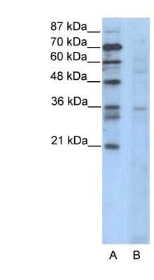 Western Blot: CCNB3 Antibody [NBP1-80127] - Titration: 2.5ug/ml, Positive Control: Jurkat cell lysate.