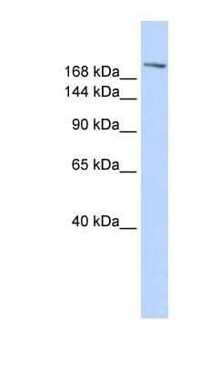 Western Blot: CCNB3 Antibody [NBP1-80384] - Human Muscle lysate, concentration 0.2-1 ug/ml.