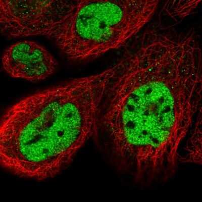 Immunocytochemistry/Immunofluorescence: CCNDBP1 Antibody [NBP2-58940] - Staining of human cell line A-431 shows localization to nucleoplasm.