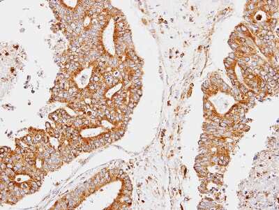 Immunohistochemistry-Paraffin: CCNDBP1 Antibody [NBP2-15762] - Immunohistochemical analysis of paraffin-embedded endo mitrial, using antibody at 1:100 dilution.