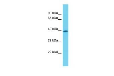 Western Blot: CCNJL Antibody [NBP2-82635] - Host: Rabbit. Target Name: CCNJL. Sample Type: MDA-MB-435S Whole Cell lysates. Antibody Dilution: 1.0ug/ml