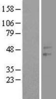 Western Blot: CCNJL Overexpression Lysate (Adult Normal) [NBL1-08886] Left-Empty vector transfected control cell lysate (HEK293 cell lysate); Right -Over-expression Lysate for CCNJL.