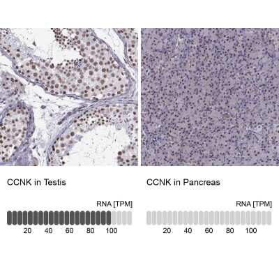 Immunohistochemistry-Paraffin: CCNK Antibody [NBP2-62712] - Analysis in human testis and pancreas tissues using Anti-CCNK antibody. Corresponding CCNK RNA-seq data are presented for the same tissues.