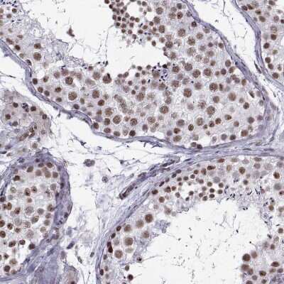 Immunohistochemistry-Paraffin: CCNK Antibody [NBP2-62712] - Staining of human testis shows high expression.