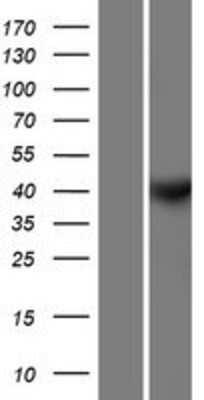 Western Blot: CCNY Overexpression Lysate (Adult Normal) [NBP2-09979] Left-Empty vector transfected control cell lysate (HEK293 cell lysate); Right -Over-expression Lysate for CCNY.