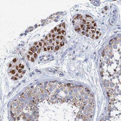 Immunohistochemistry-Paraffin: CCP110 Antibody [NBP2-13073] - Staining of human testis shows strong cytoplasmic positivity in Leydig cells.