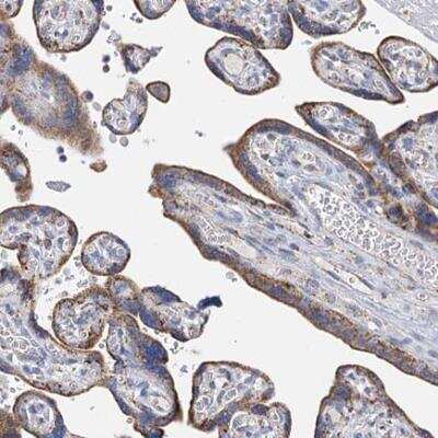 Immunohistochemistry-Paraffin: CCP110 Antibody [NBP2-13073] - Staining of human placenta shows moderate cytoplasmic positivity in trophoblastic cells.