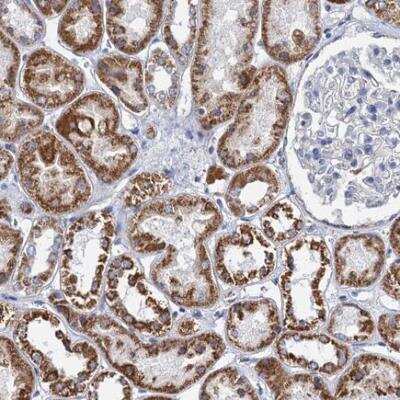 Immunohistochemistry-Paraffin: CCP110 Antibody [NBP2-13073] - Staining of human kidney shows moderate cytoplasmic positivity in cells in tubules.