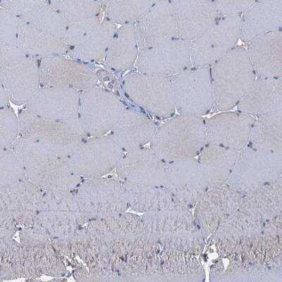 Immunohistochemistry-Paraffin: CCP110 Antibody [NBP2-13073] - Staining of human skeletal muscle shows no positivity in myocytes as expected.