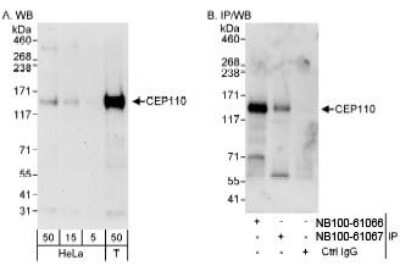 Western Blot: CCP110 Antibody [NB100-61066] - Detection of Human CEP110 on HeLa whole cell lysate using NB100-61066. CEP110 was also immunoprecipitated, albeit less efficiently, by rabbit anti-CEP110 antibody NB100-61067.