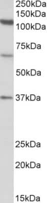 Western Blot: CCP110 Antibody [NBP2-26118] - Staining of Human Testis lysate (35 ug protein in RIPA buffer). Primary incubation was 1 hour. Detected by chemiluminescence.  