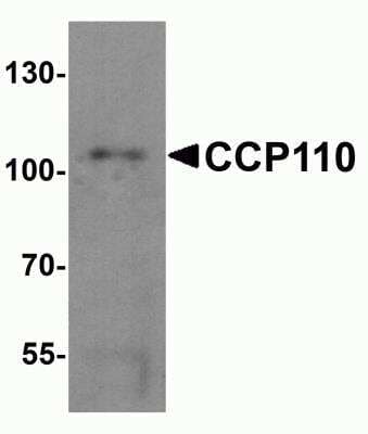 Western Blot: CCP110 Antibody [NBP2-81976] - Analysis of CCP110 in human colon tissue lysate with CCP110 antibody at 1 ug/ml.