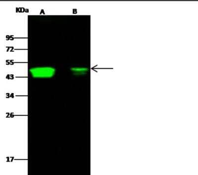 Western Blot: CCR1 Antibody (002) [NBP2-89234] - Lane A: HEK293 Whole Cell Lysate Lane B: 293T Whole Cell LysateLysates/proteins at 30 ug per lane. Secondary Goat Anti-Rabbit IgG H&L (Dylight800) at 1/10000 dilution. Developed using the Odyssey technique. Performed under reducing conditions. Predicted band size:43 kDa Observed band size:49 kDa