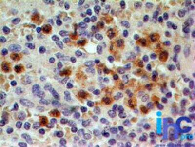 Immunohistochemistry-Paraffin: CCR1 Antibody [NB100-56334] - Normal human spleen tissue stained with this at 5 ug/ml, peroxidase-conjugate and DAB chromogen. Note granulocyte staining.