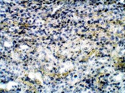 Immunohistochemistry-Paraffin: CCR1 Antibody [NBP1-78173] - Mouse Spleen. 1:50 dilution in IHC blocking buffer. DAB (brown) staining and Hematoxylin QS (blue) counterstain. 40X mangification. FFPE secction.