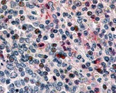 Immunohistochemistry-Paraffin: CCR1 Antibody [NBP2-31088] - Analysis of spleen (lymphocytes) using  this antibody at 5 ug/ ml.