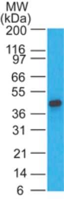 Western Blot: CCR1 Antibody [NB100-56334] - A375 lysate probed with this antibody at 2 ug/ml dilution.