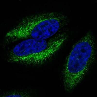 Immunocytochemistry/Immunofluorescence: CCR10/GPR2 Antibody [NBP2-56272] - Staining of human cell line HeLa shows localization to endoplasmic reticulum.