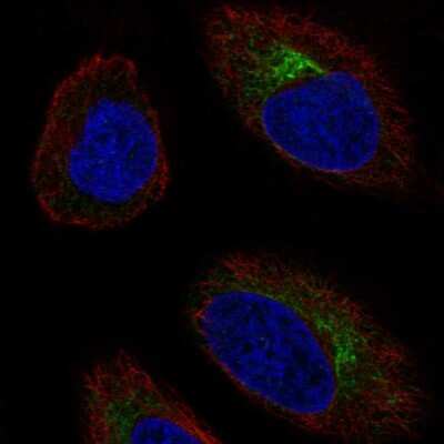 Immunocytochemistry/Immunofluorescence: CCR10/GPR2 Antibody [NBP2-56544] - Staining of human cell line HeLa shows localization to endoplasmic reticulum.