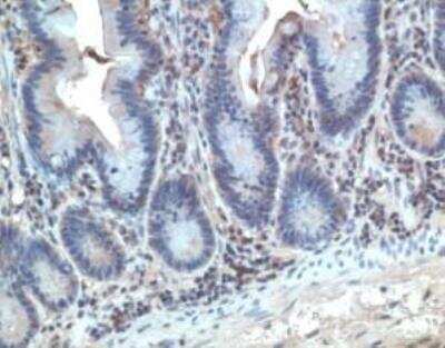 Immunohistochemistry: CCR10/GPR2 Antibody [NB100-707] - Paraffin section of human tonsil.