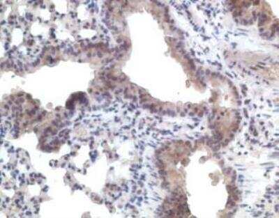Immunohistochemistry-Paraffin: CCR11 Antibody [NB100-705] -  paraffin section mouse lung