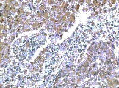 Immunohistochemistry-Paraffin: CCR11 Antibody [NB100-705] - Immunohistochemistry with antibody to human CCR11 on paraffin section of human lung.