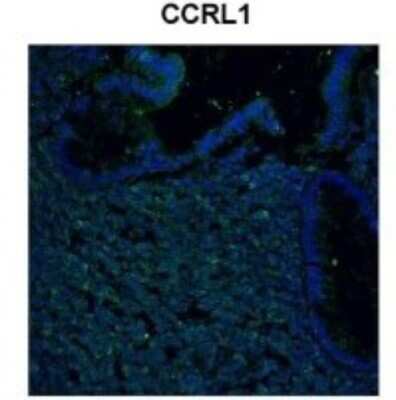 Immunohistochemistry-Paraffin: CCR11 Antibody [NBP1-79925] - Sample Type: human colon tissues infected ex-vivo with HIV-1, Green: Primary, Blue: DAPI, Primary Dilution: 1:1000, Secondary Antibody: Donkey anti-Rabbit AF 488, Secondary Dilution: 1:500, Image Submitted By: Chiara Foglieni, San Raffaele Scientific Inst