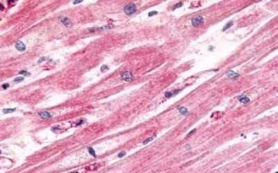 Immunohistochemistry-Paraffin: CCR11 Antibody [NLS1441] - Anti-CCRL1 antibody IHC of human heart, cardiac myocytes. Immunohistochemistry of formalin-fixed, paraffin-embedded tissue after heat-induced antigen retrieval.