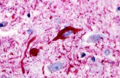 Immunohistochemistry-Paraffin: CCR11 Antibody [NLS1441] - Brain, Alzheimer's disease neurofibrillary tangle