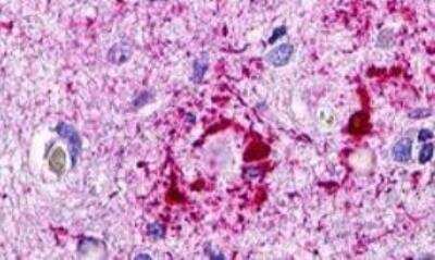 Immunohistochemistry-Paraffin: CCR11 Antibody [NLS1441] - Brain, Alzheimer's disease senile plaque