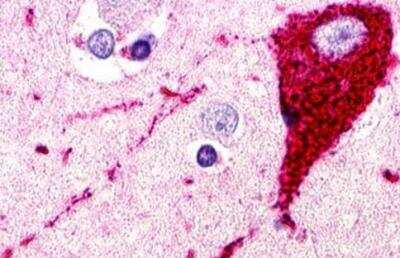 Immunohistochemistry-Paraffin: CCR11 Antibody [NLS1441] - Brain, Amygdala
