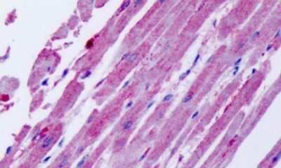 Immunohistochemistry-Paraffin: CCR11 Antibody [NLS1442] - Anti-CCRL1 / CCR11 antibody IHC of human heart. Immunohistochemistry of formalin-fixed, paraffin-embedded tissue after heat-induced antigen retrieval. Antibody dilution 24-32 ug/ml.