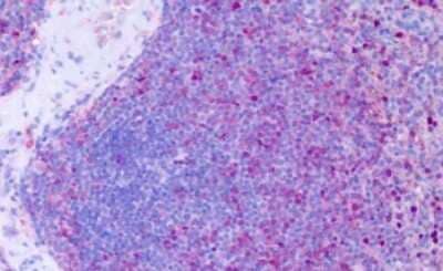 Immunohistochemistry-Paraffin: CCR11 Antibody [NLS1442] - Anti-CCRL1 / CCR11 antibody IHC of human spleen. Immunohistochemistry of formalin-fixed, paraffin-embedded tissue after heat-induced antigen retrieval. Antibody dilution 24-32 ug/ml.