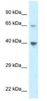 Western Blot: CCR11 Antibody [NBP1-79925] - 293T cell Lysate, concentration 1ug/ml.