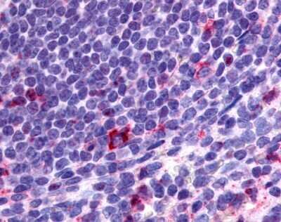 Immunohistochemistry-Paraffin: CCR2 Antibody [NLS1899] - Analysis of anti-CCR2 antibody with human spleen, lymphocytes at 3 ug/ml.