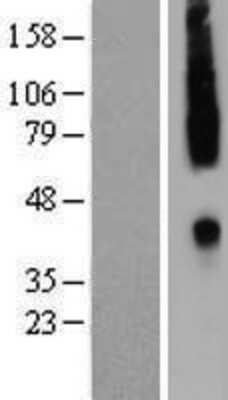 Western Blot: CCR2 Overexpression Lysate (Adult Normal) [NBP2-09004] Left-Empty vector transfected control cell lysate (HEK293 cell lysate); Right -Over-expression Lysate for CCR2.