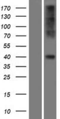 Western Blot CCR2 Overexpression Lysate