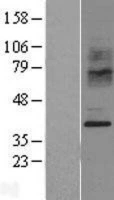 Western Blot CCR2 Overexpression Lysate