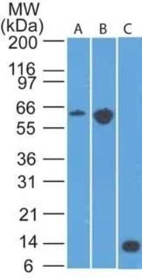 Western Blot: CCR6 Antibody (18B9E6) - Azide Free [NBP2-25224] - analysis of A) mouse EL4, B) conA  treated EL4 lysate and C) partial recombinant protein using CD196 antibody at 2 ug/ml.