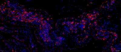 Immunohistochemistry-Paraffin: CCR6 Antibody (18B9E6) - BSA Free [NBP2-25220] - CCR6 staining using GE Cell DIVE (20x) on Human Rheumatoid Arthritis synovium (10 ug/ml w/ 1:500 Donkey anti-Rat AF555). Image from verified customer review.