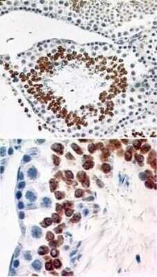 Immunohistochemistry-Paraffin: CCR6 Antibody (18B9E6) [NBP2-25220] - Normal mouse testis tissue stained with CD196 antibody (5 ug/ml), peroxidase-conjugate and DAB chromogen. Note cytoplasmic and membrane staining.