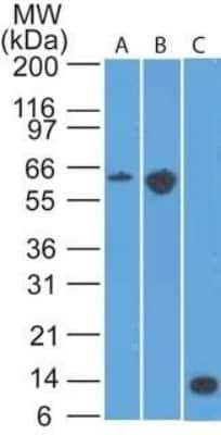 Western Blot: CCR6 Antibody (18B9E6) [NBP2-25220] -  A) mouse EL4, B) conA treated EL4 lysate and C) partial recombinant protein using CD196 antibody at 2 ug/ml.