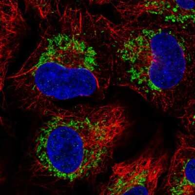 Immunocytochemistry/Immunofluorescence: CCR7 Antibody [NBP2-57375] - Staining of human cell line A549 shows localization to mitochondria.