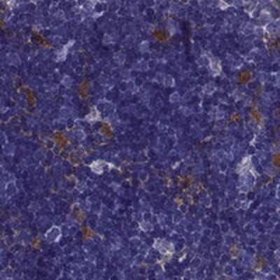 Immunohistochemistry-Paraffin: CCR8 Antibody [NBP2-68645] - Staining of human thymus shows strong cytoplasmic positivity in cortical cells.