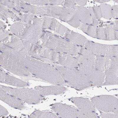 Immunohistochemistry-Paraffin: CCR8 Antibody [NBP2-68645] - Staining of human skeletal muscle shows not postivity in myocytes as expected.